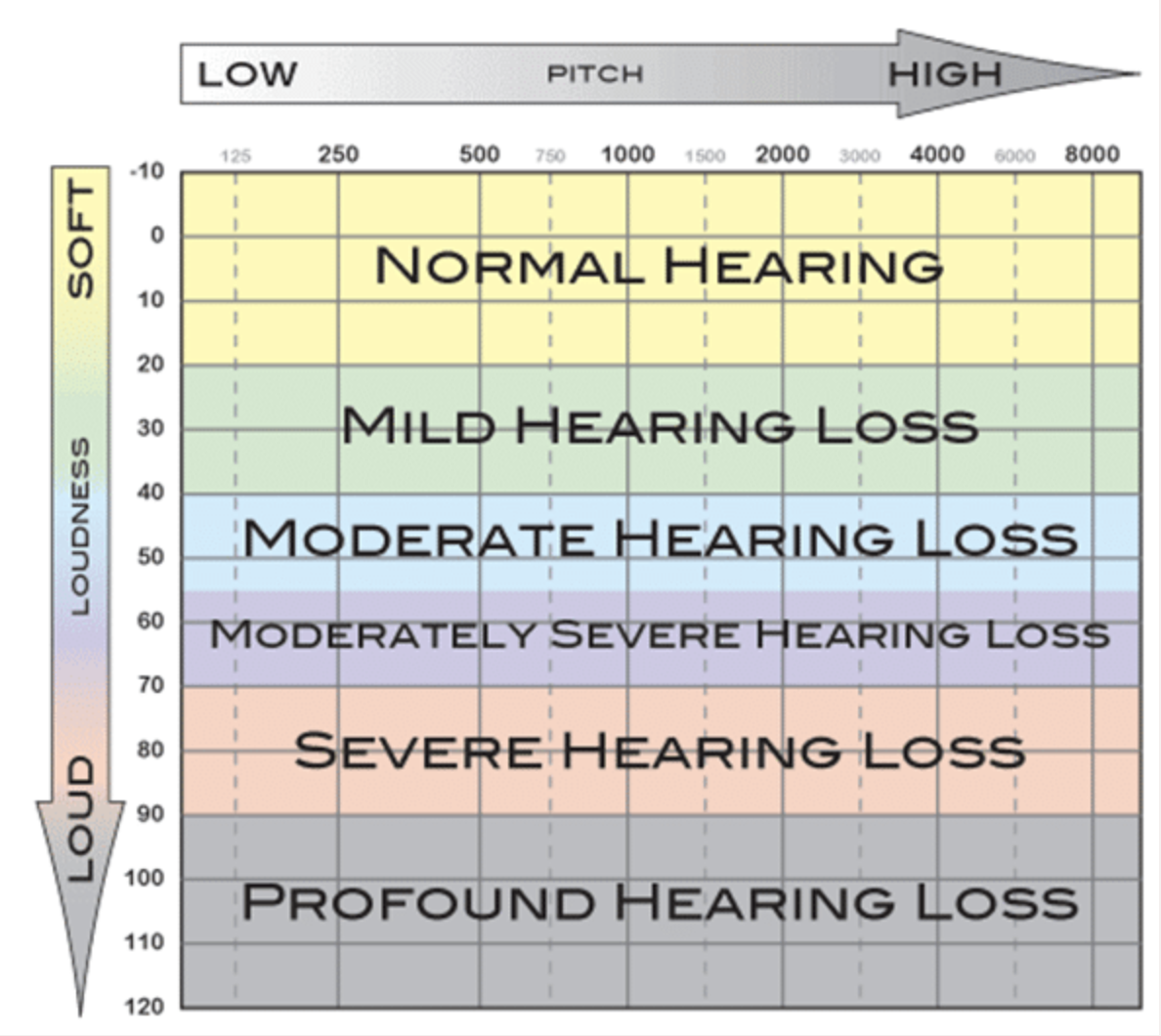 05 hearing loss levels