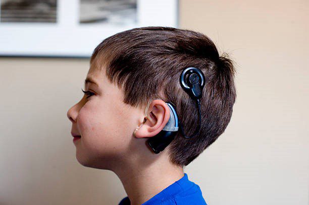 06 cochlear implant